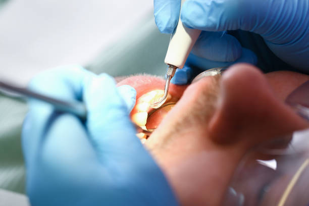 Best Emergency Treatment for Toothache in Hardeeville, SC