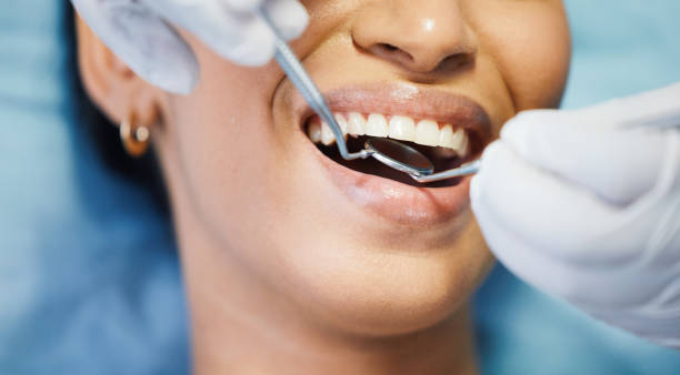 Best Emergency Root Canal Treatment in Hardeeville, SC